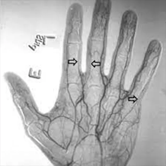 CT Hand Angiography Test
